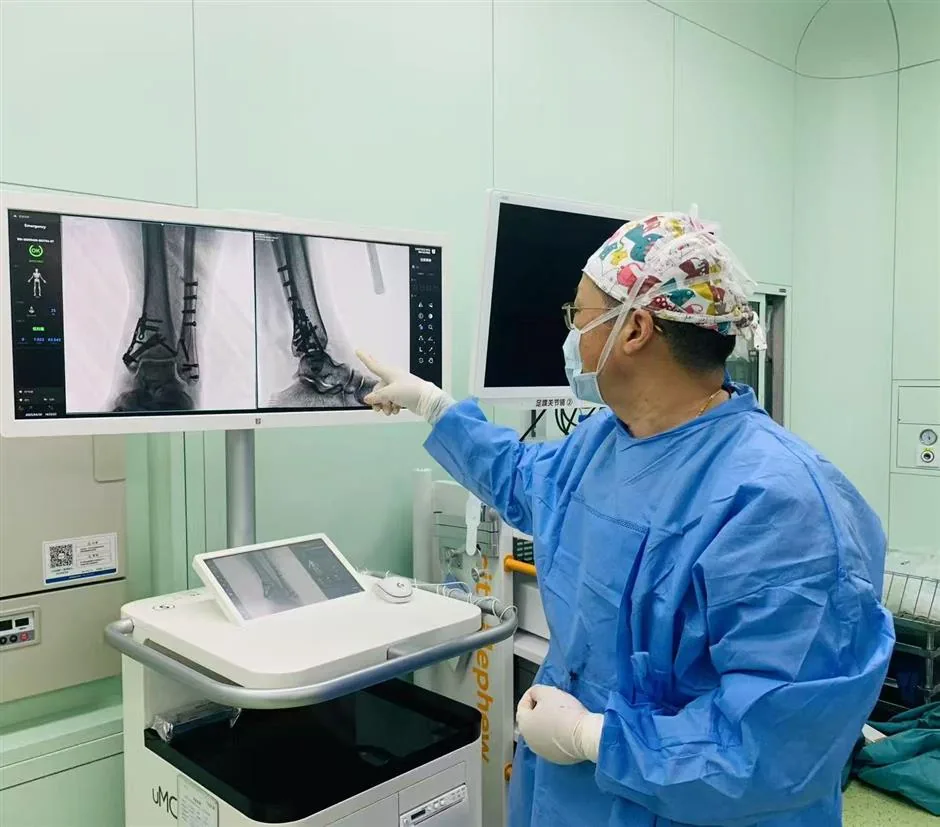 Sixth People’s Hospital clinician reviewing fracture imaging with technology in a hospital-supplied 2025 photograph